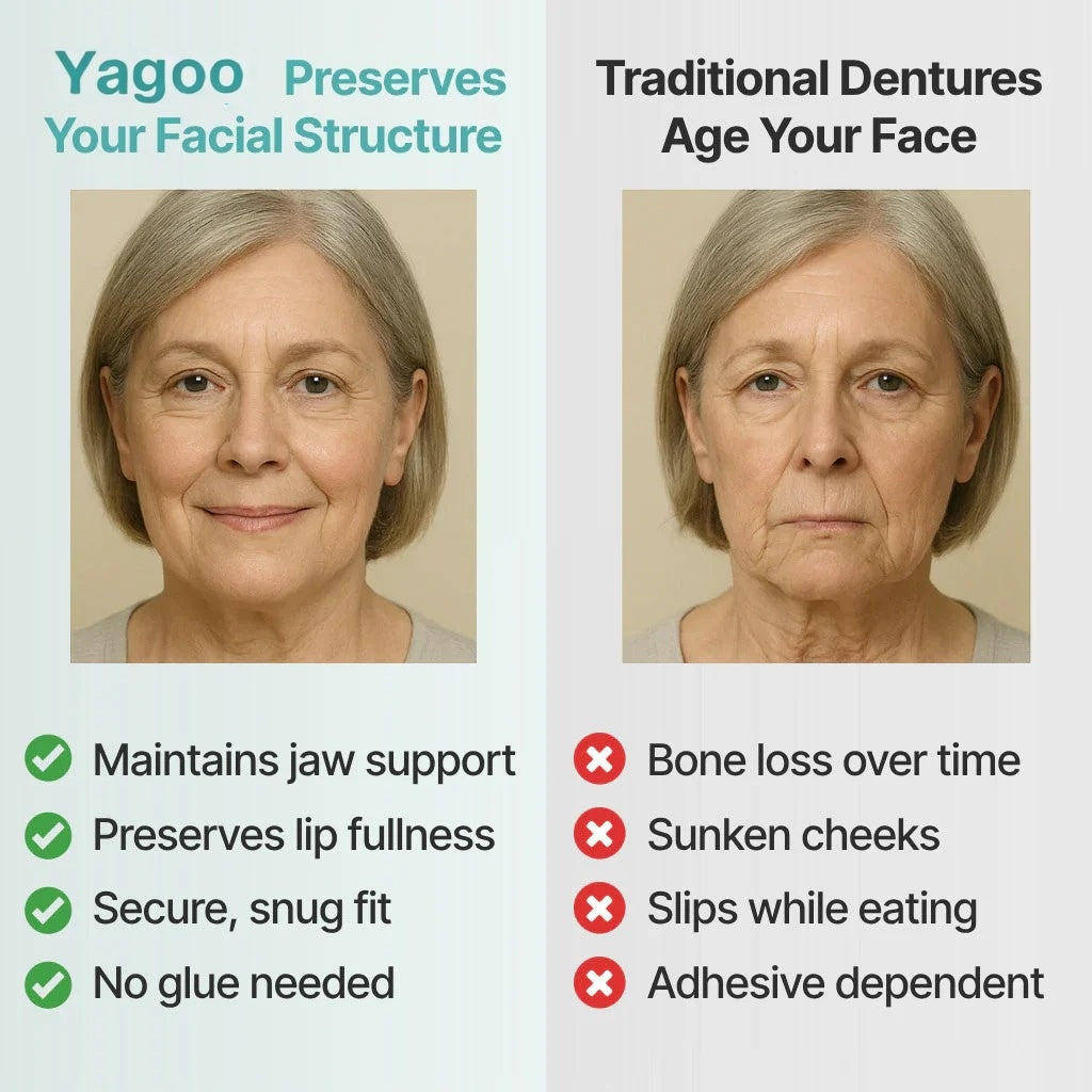 🌎Ends Today: 70% OFF! ⏰Yagoo™ Medical Full Denture with Strong Suction